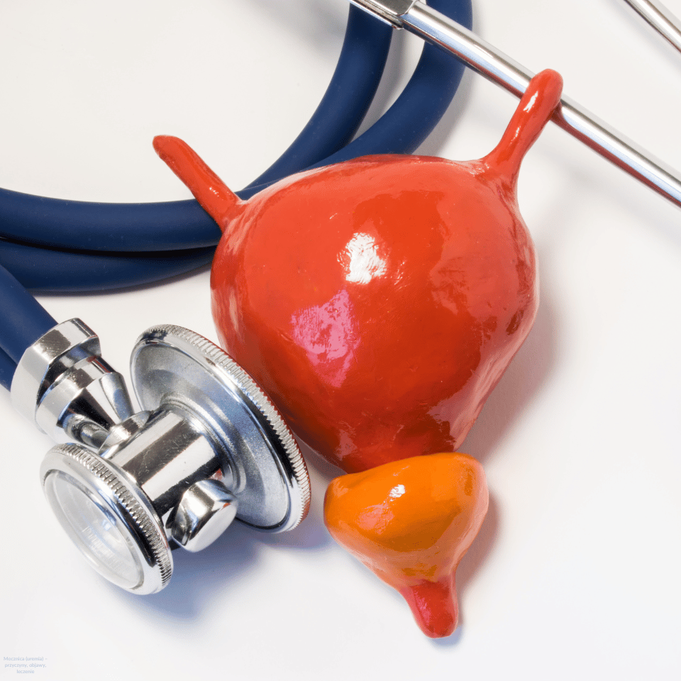 Gruczolak prostaty (gruczołu krokowego) – przyczyny, objawy, diagnostyka i leczenie