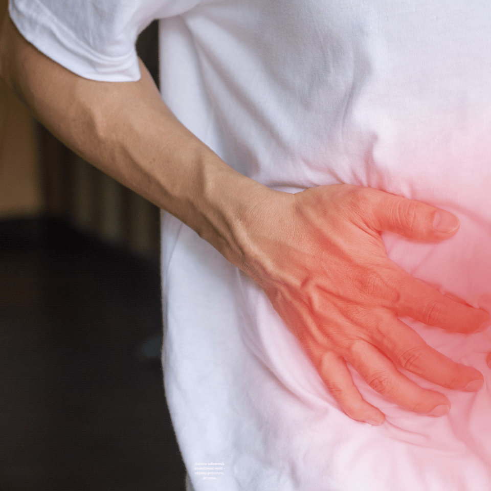 Kamica odlewowa (struwitowa) nerki – objawy, przyczyny, leczenie