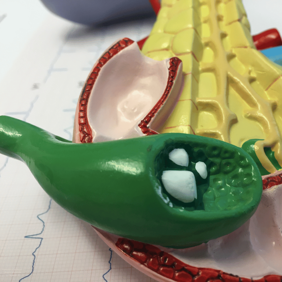 Kamienie w pęcherzu – objawy, przyczyny, leczenie