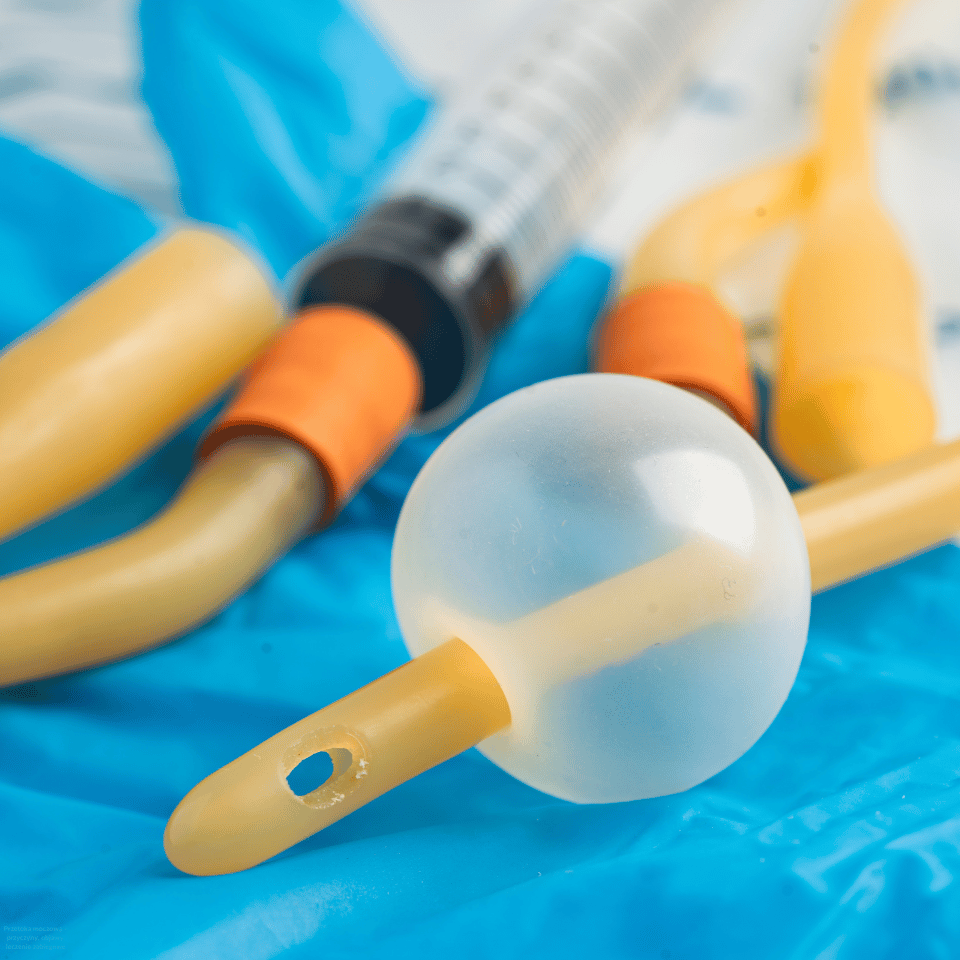 Przetoka moczowa – przyczyny, objawy, leczenie zabiegowe