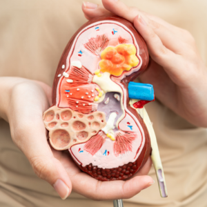 Aplazja nerki – objawy, przyczyny, leczenie